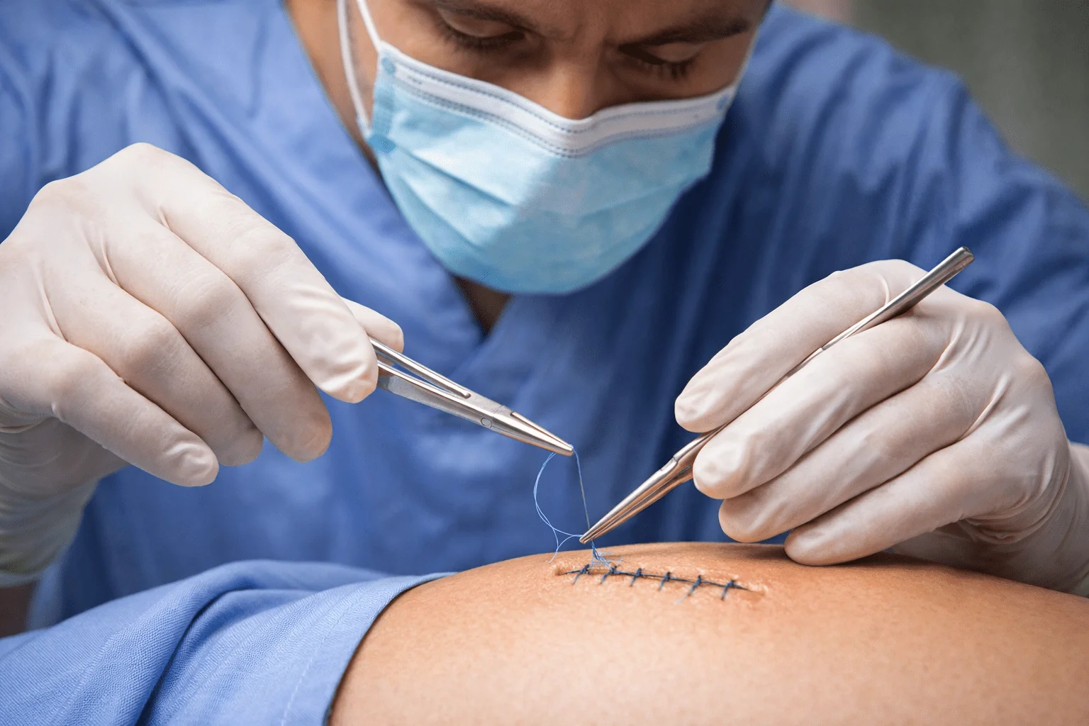 Specialized home surgical wound care and diabetic foot treatment by Clinica experts.